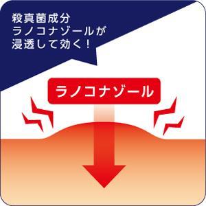 水虫・たむしによく効く水虫薬の液タイプ 第一三共ヘルスケア 【送料無料】ピロエースZ液 15mL【指定第2類医薬品】 ※セルフメディケーション税制対象商品