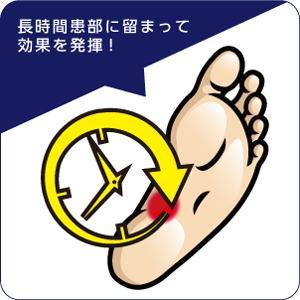 水虫・たむしによく効く水虫薬の液タイプ 第一三共ヘルスケア 【送料無料】ピロエースZ液 15mL【指定第2類医薬品】 ※セルフメディケーション税制対象商品